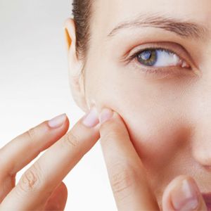 Como evitar a acne e suas cicatrizes?